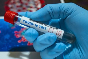 В Україні за добу зафіксували понад 11 тисяч нових хворих коронавірусом, на Волині – 374