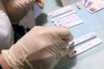 Лучан безкоштовно тестуватимуть на гепатит та ВІЛ