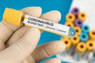 На Волині за добу − 249 нових хворих та 2 смерті від COVID-19