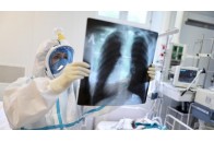 Коронавірус на Волині: більше 300 нових хворих та 3 смерті за добу