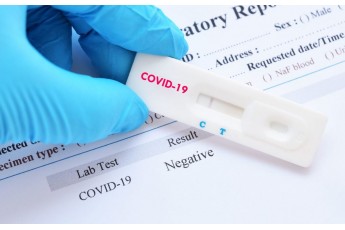 Covid-19: краще перехворіти чи вакцинуватися (дослідження)