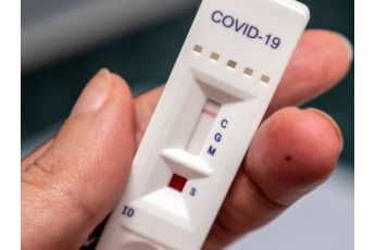 COVID-19 на Волині: за добу – майже 400 нових хворих та 7 смертей (статистика)