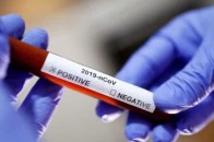 Чому коронавірус забирає відчуття смаку