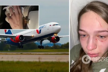 Молодій українці в літаку роздряпали обличчя і відгризли ніготь (фото, відео 18+)