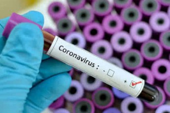 Швидкі тести на COVID-19 пропускають значну кількість заражених людей
