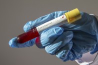 В Україні виявили 591 новий випадок захворювання на коронавірус