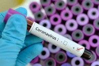 В Україні за добу – 182 хворих на коронавірус (статистика)