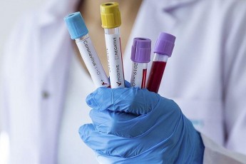 В Україні – 300 нових випадків коронавірусу за добу