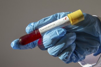 В Україні виявили 749 нових випадків захворювання на коронавірус